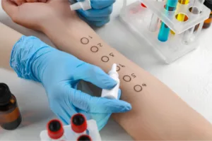 Imunoalergologia